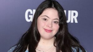 Mosaic Down Syndrome Celebrities